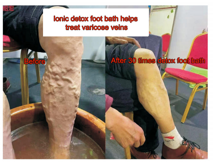 What Disease Can Ionic Foot Bath Heal?